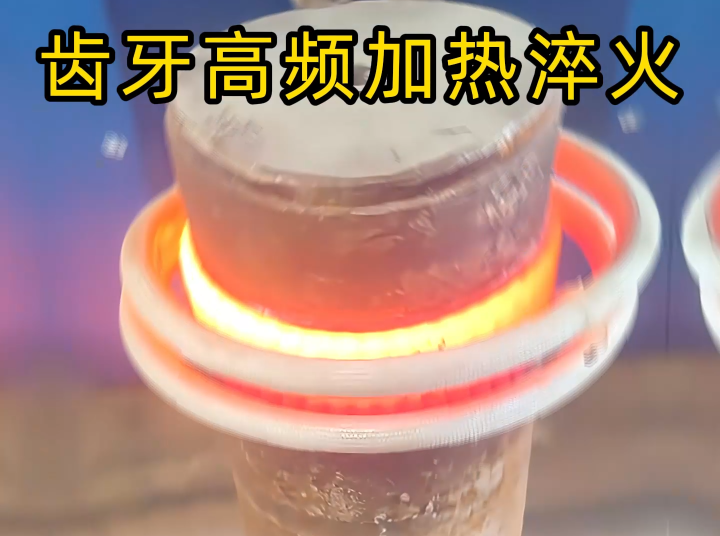 齒輪齒麵高頻香蕉视频污版淬火：現代機械傳動的關鍵表麵強化工藝